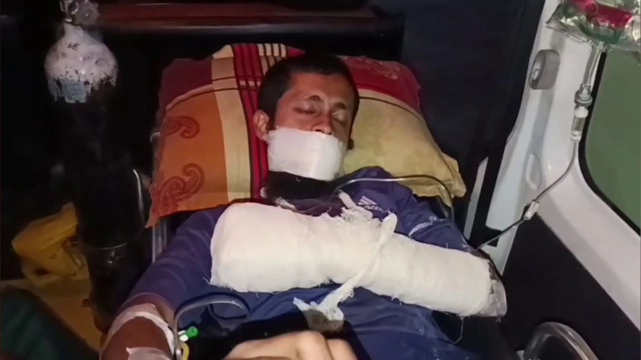 টুঙ্গিপাড়ায় বিস্ফোরণে যুবক দগ্ধ, ককটেল তৈরির সন্দেহ